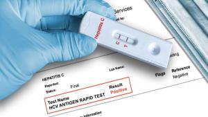 Hepatita B și C: rom&acirc;nii pot fi testați gratuit, cu bilet de trimitere de la medic