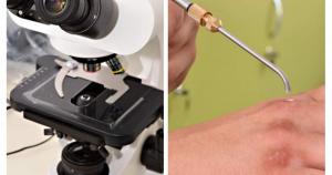 Aparat unic &icirc;n țară care poate depista cancerul de piele, bolile inflamatorii, imunologice și degenerative