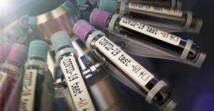 PSD: Miniștrii Sănătății de la USR să &icirc;nceteze să mai dea vina pe ultimii 30 de ani! Valul patru al pandemiei trebuia pregătit &icirc;n acest an!