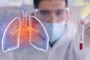 246 de noi cazuri de infecții cu COVID-19. 11 decese &icirc;n ultimele 24 de ore