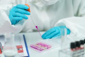 Caz de variola maimuţei la un t&acirc;năr de 22 de ani