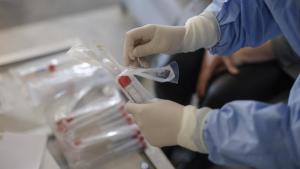 Terasă din Vama Veche &icirc;nchisă, după ce o angajată de la bar a fost infectată cu COVID-19